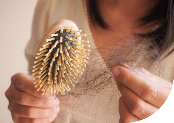 eine Frau hält eine Kämmbürste mit vielen Haaren in der Hand